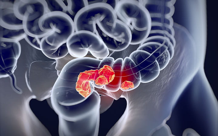 colon image