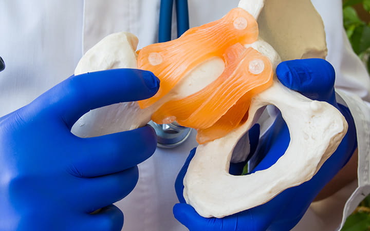 hip joint replacement
