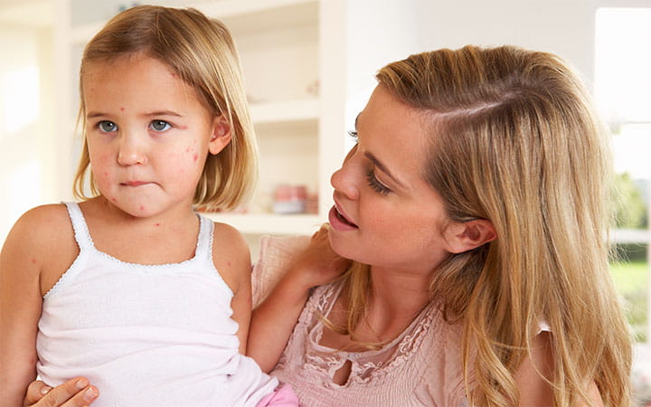 mom with girl measles