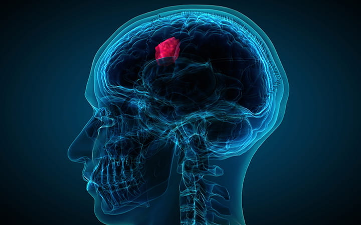 brain