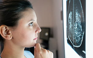 The Best Way to Survive Breast Cancer: Catch It Early