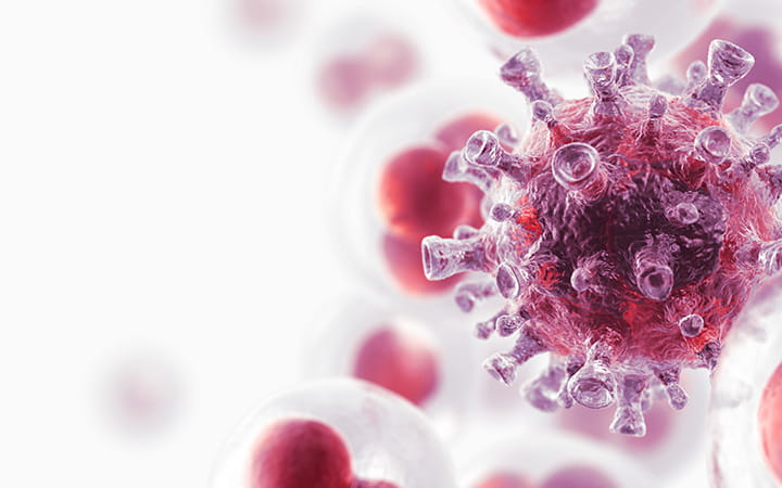 glioblastoma
