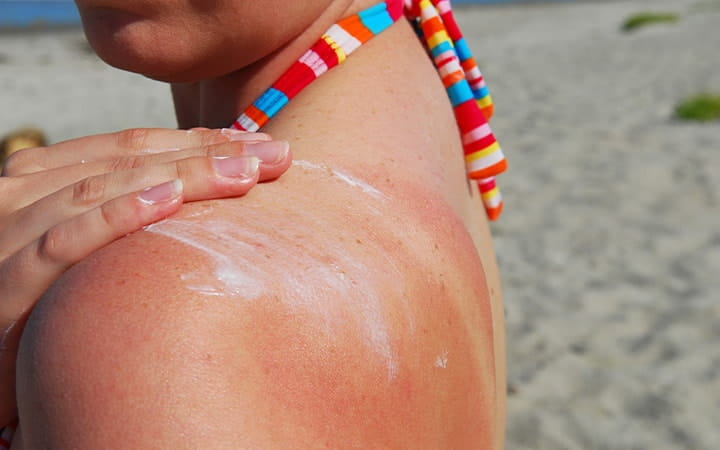Woman applies suntan lotion