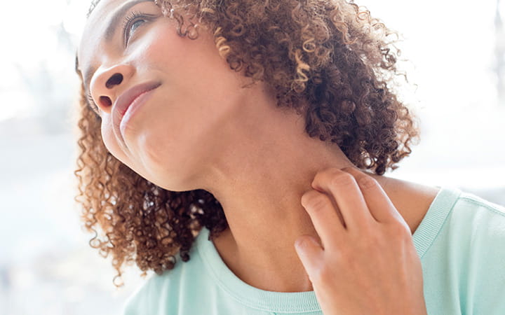 skin conditions