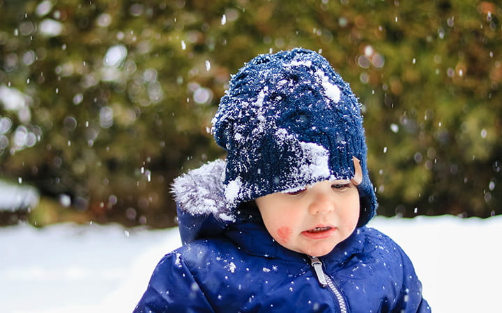 cold urticaria