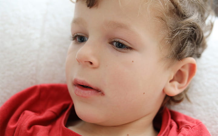 childhood skin problems
