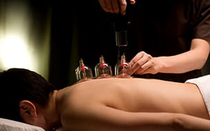 therapist places cups on patient's back