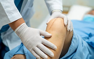 Female patient shows her scars after total knee joint replacement surgery