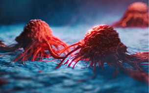 Therapy for Multiple Myeloma Has New Approach With One-Time Treatment