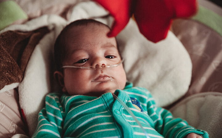 A baby wearing nasal canula and oxygen relaxes at home in a chair