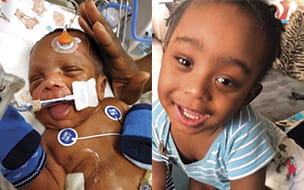 Toddler Thrives After Receiving Kidney Transplant at UH Rainbow