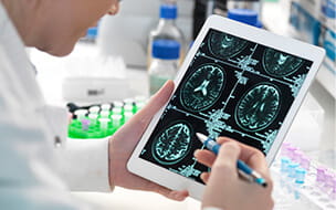 New Research Holds Promise for Alzheimer’s Disease
