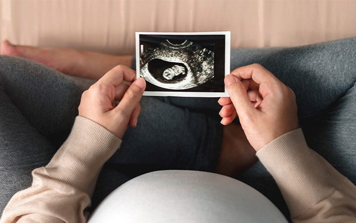 Pregnant woman looking at ultrasound photo