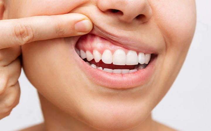 Young woman showing her healthy gums