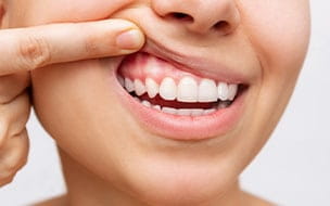 Young woman showing her healthy gums