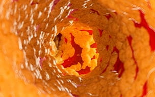 There’s More to Heart Disease Risk Than Cholesterol