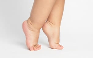 What Parents Should Know About Toe Walking