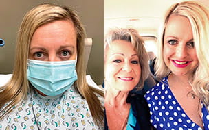 Danielle before and after surgery