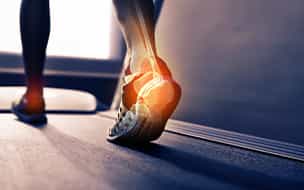 Achilles Tendinopathy: What to Do About a Chronic Problem