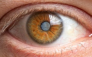 Inherited Eye Diseases: The Importance of Early Diagnosis