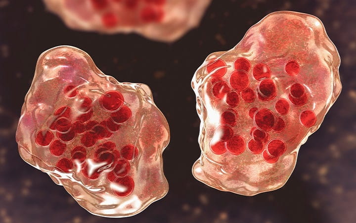Illustration of measles virus infection