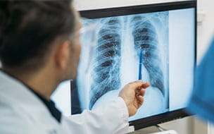 Popcorn Lung: A Dangerous Risk of Vaping