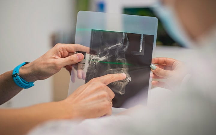 Close-up view of a jaw scan