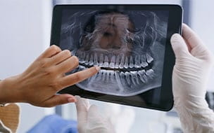 The Link Between Diabetes and Gum Disease