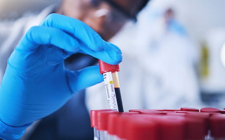 A researcher holds a vial containing blood