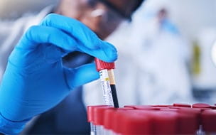 New Blood Test for Colorectal Cancer: What to Know