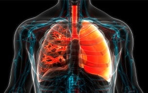 Another Kind of High Blood Pressure: Pulmonary Hypertension
