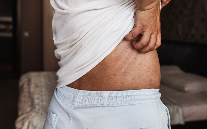 Man scratching his back