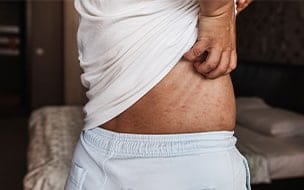 Can Chronic Itchiness Be a Sign of Disease?