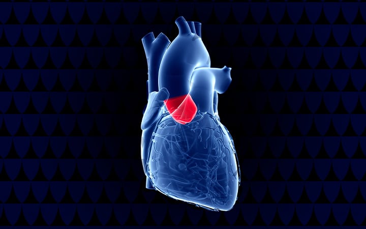 An illustration of the aortic valve