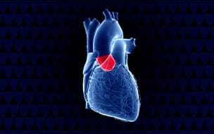 An illustration of the aortic valve