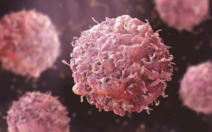 Illustration of cancer cells