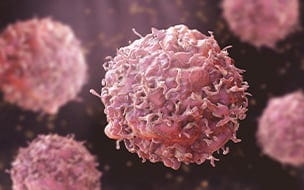 Cancer Is Becoming More Common, Also More Treatable
