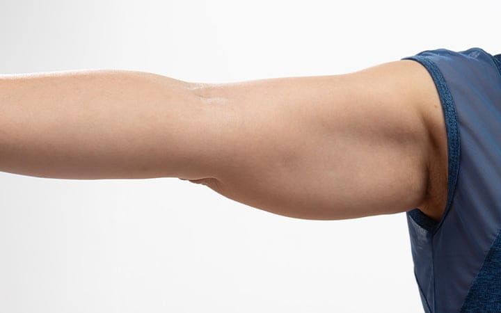 A flabby outstretched arm