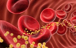 Can a Cholesterol Drug Help Treat Cancer?