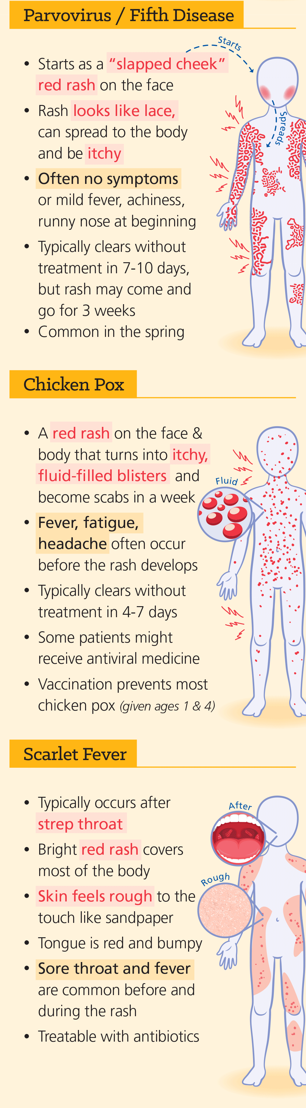 Infographic: Worried About Measles? 5 Common Infections With Similar Symptoms