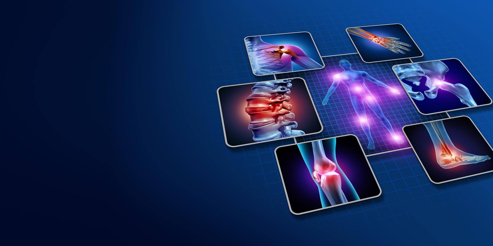 Orthopedic illustration of bone scans