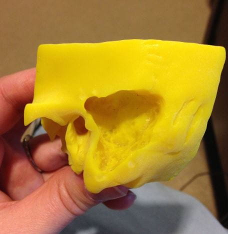 3D Image 2