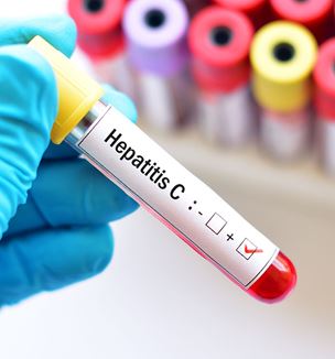 Hepatitis test