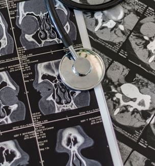 Tomography scan for ENT