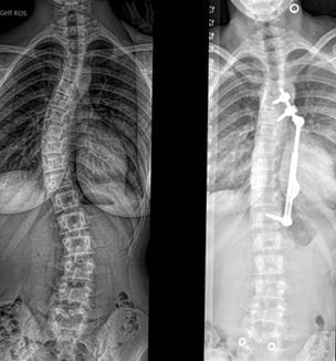 ApiFix procedure image
