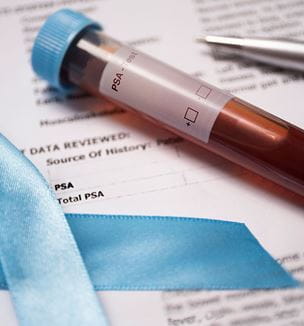 PSA blood draw image