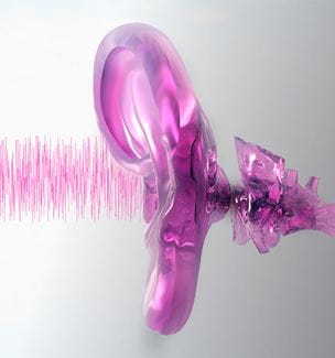 White noise earing concept for Cochlear Implant