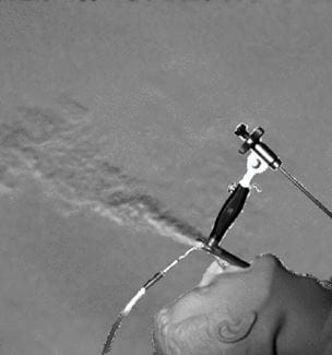 Example processed BOS image of jet ventilation on a manikin