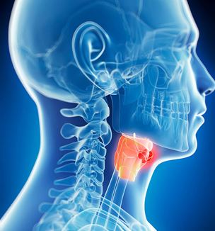 Laryngectomy illustration