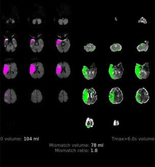 Select2 Clinical Trial scan image for Innovations Summer 2022 article